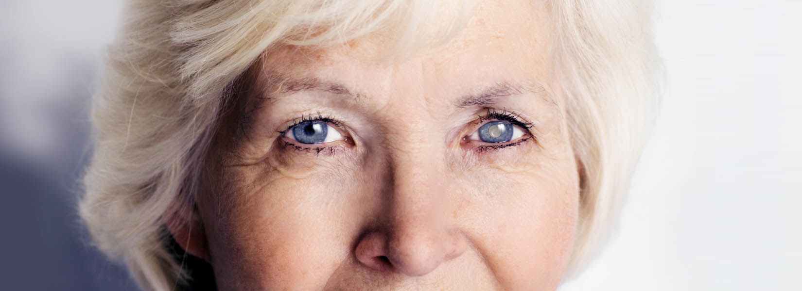 Cataract Surgery in Laurie
